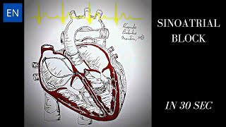 Sinoatrial Block Animation and ECG Shorts [upl. by Egoreg]