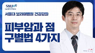 점처럼 생긴 암 당장 이 사진과 비교해보세요 피부암과 켈로이드성형외과 박지웅 교수 건강강좌 [upl. by Fang]