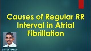 Causes of Regular RR Interval in Atrial Fibrillation [upl. by Haimehen649]