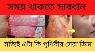 Gomela fairness cream review পৃথিবীর সেরা নাইট ক্রিম [upl. by Accissej]