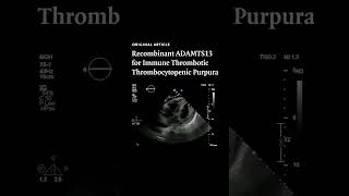 Recombinant ADAMTS13 for Immune Thrombotic Thrombocytopenic Purpura  NEJM [upl. by Yttak]