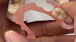 Prótese Dentária Flexível Como Encaixa na Boca [upl. by Ordway692]