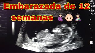 Ultrasonido 12 semanas Embarazo de 12 semanas😘🤰🏻👶🏻🤱🏻 [upl. by Ettelimay]