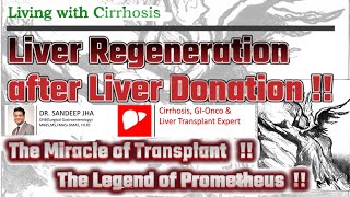 Liver Regeneration after Donor Hepatectomy [upl. by Sik413]