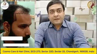 Dr Rahul Goyal  hair Transplant  Chandigrah Sector 32D [upl. by Korenblat308]