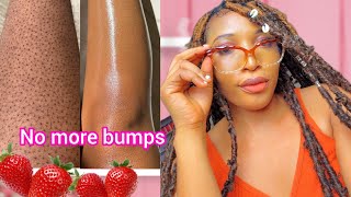 How to get rid of strawberry legs fast No more bumby skinsmooth and radiant legs [upl. by Rydder886]