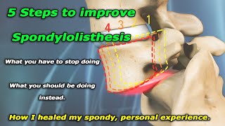 Spondylolisthesis 101 or how I healed my broken back [upl. by Eimia]