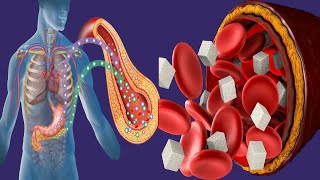 Hypoglycemia Without Diabetes Causes And Symptoms [upl. by Ahsekahs]