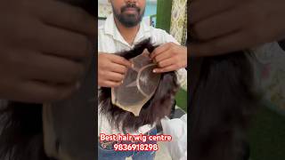 Best hair wigs shop in Kolkata Best hair patch centre for men’s Baldness solvehaircarespecialist [upl. by Dnilazor]