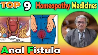 Anal Fistula Causes Symptoms and homeopathy Treatment  Dr P S Tiwari [upl. by Orian]