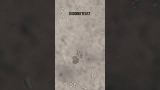 Budding Yeast in Urine Microscopic  shorts youtubeshorts urine pathology [upl. by Ennirac580]