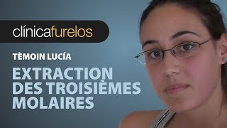 Lucia Extraction des troisièmes molaires [upl. by Norab]