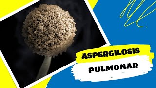 Aspergilosis Pulmonar un hongo invasivo [upl. by Eniawtna427]