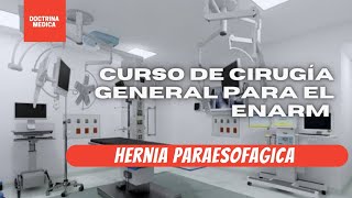 HERNIA PARAESÓFAGA GPC ER EXPLICDO [upl. by Aserehs]