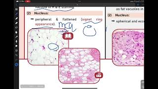 histology 36 connective  Types of ct 2 [upl. by Grondin]