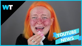 Permanent FRECKLE Beauty FAIL Goes VIRAL [upl. by Mirak]