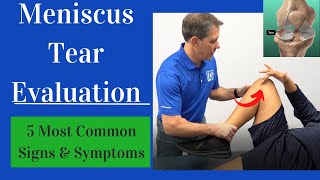 Meniscus Tear Evaluation 5 Most Common Signs and Symptoms [upl. by Survance]