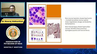 APPROACH TO PATIENTS WITH PANCYTOPENIA MAY 2023 [upl. by Octavius]