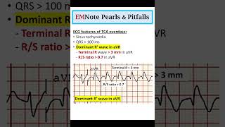 ECG Changes of TCA Overdose doctor medical nursing [upl. by Furr]