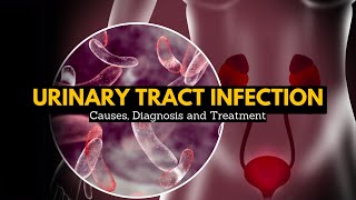 Urinary Tract Infection Causes Signs and Symptoms Diagnosis and Treatment [upl. by Burdelle]