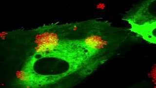 Etat de la recherche  Alerte au méningocoque [upl. by Aniraz]