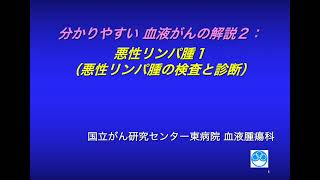 分かりやすい血液がんの解説 ２： 悪性リンパ腫の検査と診断【国立がん研究センター東病院】 [upl. by Ydroj]