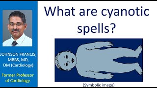 What are cyanotic spells [upl. by Aidan]