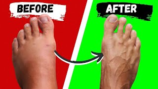 How To Shrink Swollen Ankles To Look Skinny Again [upl. by Ahsiret929]