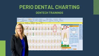 Perio Dental Charting  Dentech Training [upl. by Adnalu917]