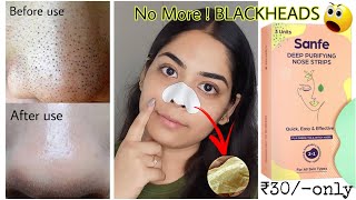 Amazing 😱 Sanfe Deep purifying Nose Strips  How to Apply for best results ❌BLACKHEADSWHITEHEADS [upl. by Asnerek]