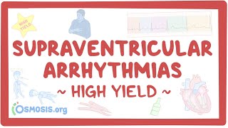 Supraventricular arrhythmias Pathology review [upl. by Seko655]