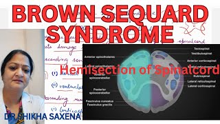 Brown Sequard Syndrome Hemisection of Spinal cord [upl. by Harli]