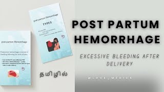 postpartum hemorrhage in tamil lovemedics [upl. by Aicnarf863]