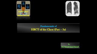 HRCT chest for Radiology Residents  Part 3a  Reticular Pattern [upl. by Savinirs]