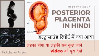 Posterior Placenta in hindi  Placenta position  placenta Grade posterior Placenta क्या होता है [upl. by Poulter]