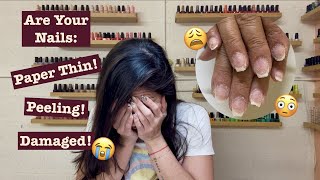 Acrylics damaged my nails How to bring damaged Nails back to health [upl. by Koffman]