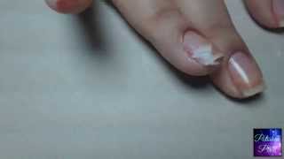 How to Repair a Nail Tear Using Tissue or TP [upl. by Alatea]