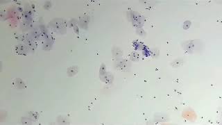 Patterns of normal endocervical cells in cervical cytology you must know [upl. by Neelahs]