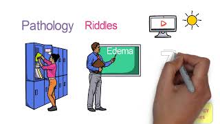 Edema Pathophysiology Part  1 Definition Physiology of Microcirculation  How Does Edema Occur [upl. by Ardnnek]