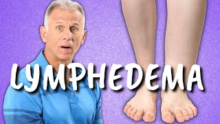 10 Exercises for Leg Lymphedema Swelling or Edema of the Lower Extremities [upl. by Merrow703]