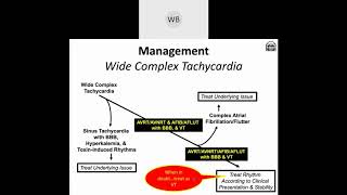 Wide Complex Tachyarrhythmias Part 3 Algorithm for Differentiation [upl. by Gareth]