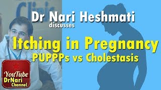 Itching in Pregnancy PUPPPs vs Cholestasis of Pregnancy Discussed by Dr Nari Heshmati [upl. by Idnew]