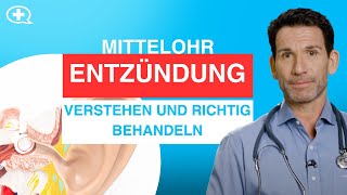 Mittelohrentzündung Wie sie entsteht und was du gegen Ohrenschmerzen tun kannst [upl. by Eetnuahs506]