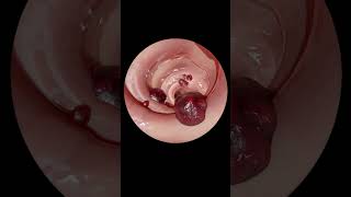 The ULTIMATE Guide to Gastrointestinal Endoscopy  Step by Step Tutorial [upl. by Acsirp]