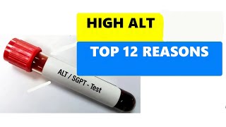 HIGH ALT LEVELS  TOP 12 REASONS [upl. by Ahseele]