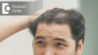 How to treat hair thinning in front part of the scalp  Dr Nischal K [upl. by Willie52]