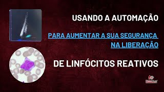 Usando a AUTOMAÇÃO para liberar LINFÓCITOS REATIVOS [upl. by Mikkel]