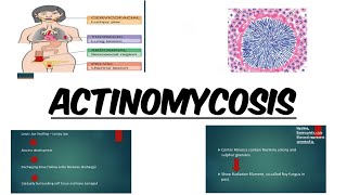 ACTINOMYCOSIS  IMAGES  MCQs [upl. by Ellynn]