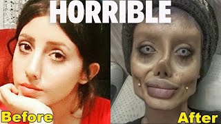 PLASTIC SURGERY Disasters That Will Leave You Speechless [upl. by Adamec]