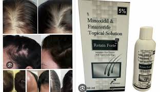 Retain Forte Stimulates Hair Growth Minoxidil amp Finasteride Topical Solution [upl. by Tivad721]